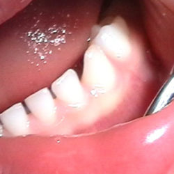 Tomar dulces a diario incrementa el riesgo de problemas dentales